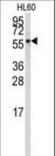 Western blot of anti-CYP4Z1 Antibody in HL60 cell line lysates (35 ug/lane). CYP4Z1(arrow) was detected using the purified antibody.
