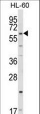 Western blot of CYP51A1 Antibody in HL-60 cell line lysates (35 ug/lane). CYP51A1 (arrow) was detected using the purified antibody.
