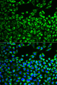 Immunofluorescence analysis of MCF-7 cell using CYP51A1 antibody. Blue: DAPI for nuclear staining.