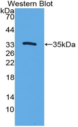 Western blot of recombinant CYP7A1.
