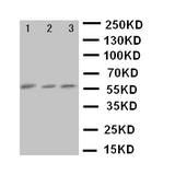 WB of CYP7A1 antibody. Lane 1: HELA Cell Lysate. Lane 2: 293T Cell Lysate. Lane 3: JURKAT Cell Lysate.