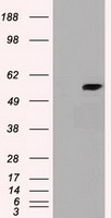 HEK293T cells were transfected with the pCMV6-ENTRY control (Left lane) or pCMV6-ENTRY cyp7b1 (Right lane) cDNA for 48 hrs and lysed. Equivalent amounts of cell lysates (5 ug per lane) were separated by SDS-PAGE and immunoblotted with anti-cyp7b1.
