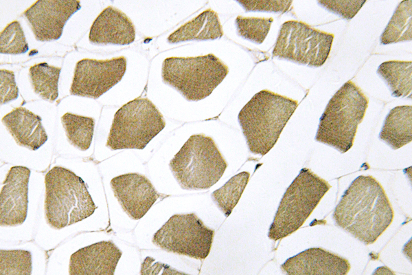 IHC of CYP7B1 (Q127) pAb in paraffin-embedded human skeletal muscle tissue.