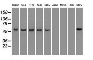 Cyp7b1 antibody (7E5) at 1:500 dilution + lysates from HEK-293T transfected with human Cyp7b1 expression vector.