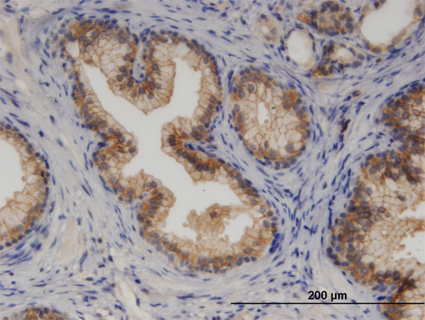 Immunoperoxidase of monoclonal antibody to CYP7B1 on formalin-fixed paraffin-embedded human prostate. [antibody concentration 3 ug/ml]