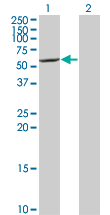 Western blot of CYP7B1 expression in transfected 293T cell line by CYP7B1 monoclonal antibody (M06), clone 2B11.
