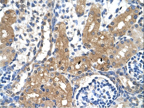 CYP4A22 antibody LS-C30534 was used in IHC to stain formalin-fixed, paraffin-embedded human kidney.