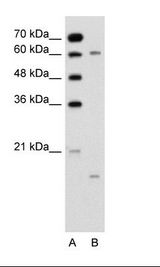 A: Marker, B: Jurkat Cell Lysate