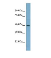 Western blot of Human NCI-H226. CYP4A22 antibody dilution 1.0 ug/ml.