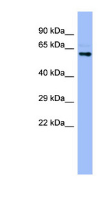 CYP4A22 antibody LS-C107633 Western blot of Fetal Stomach lysate.