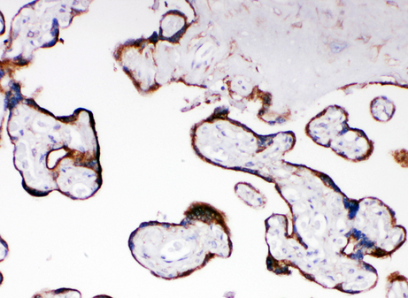 CYPOR / POR antibody. IHC(P): Human Placenta Tissue.