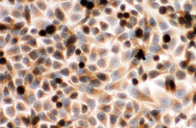 CYPOR / POR antibody. ICC: Human Placenta Tissue.