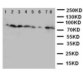 WB of CYPOR / POR antibody. Lane 1: Rat Ovary Tissue Lysate. Lane 2: Rat Lung Tissue Lysate. Lane 3: Rat Testis Tissue Lysate. Lane 4: Rat Spleen Tissue Lysate. Lane 5: A549 Cell Lysate. Lane 6: HELA Cell Lysate. Lane 7: SKOV Cell Lysate. Lane 8: MCF-7 Cell Lysate.