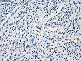 IHC of paraffin-embedded endometrium tissue using anti-POR mouse monoclonal antibody. (Dilution 1:50).