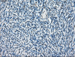 IHC of paraffin-embedded Ovary tissue using anti-POR mouse monoclonal antibody. (Dilution 1:50).