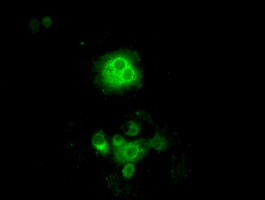 Anti-POR mouse monoclonal antibody immunofluorescent staining of COS7 cells transiently transfected by pCMV6-ENTRY POR.