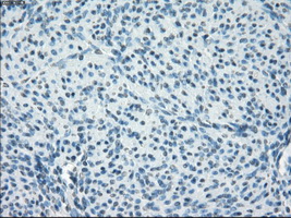 IHC of paraffin-embedded endometrium tissue using anti-POR mouse monoclonal antibody. (Dilution 1:50).