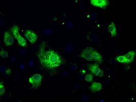 Anti-POR mouse monoclonal antibody immunofluorescent staining of COS7 cells transiently transfected by pCMV6-ENTRY POR.