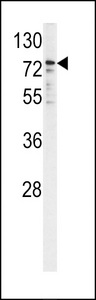 Western blot of P450R antibody in K562 cell line lysates (35 ug/lane). P450R (arrow) was detected using the purified antibody.