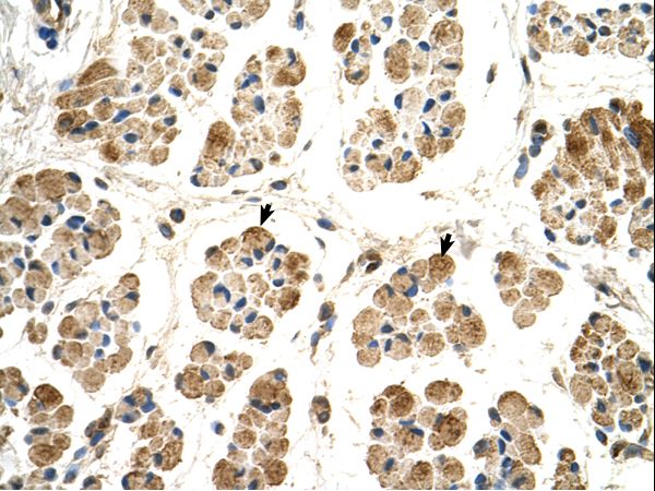 POR / CYPOR antibody LS-C80656 was used in IHC to stain formalin-fixed, paraffin-embedded human muscle.
