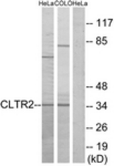 Western blot of extracts from HeLa/COLO cells, using CLTR2 Antibody. The lane on the right is treated with the synthesized peptide.