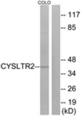 Western blot of extracts from COLO cells, using CYSLTR2 Antibody. The lane on the right is treated with the synthesized peptide.