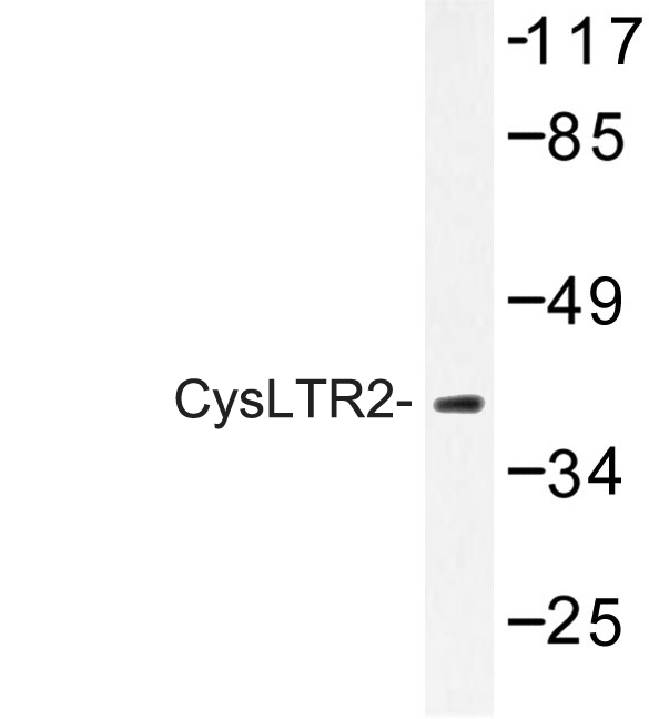 Western blot of CysLTR2 (H324) pAb in extracts from COLO cells.