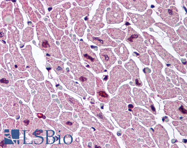 Anti-CYSLTR2 / CYSLT2 antibody LS-A2264 IHC of human heart. Immunohistochemistry of formalin-fixed, paraffin-embedded tissue after heat-induced antigen retrieval.