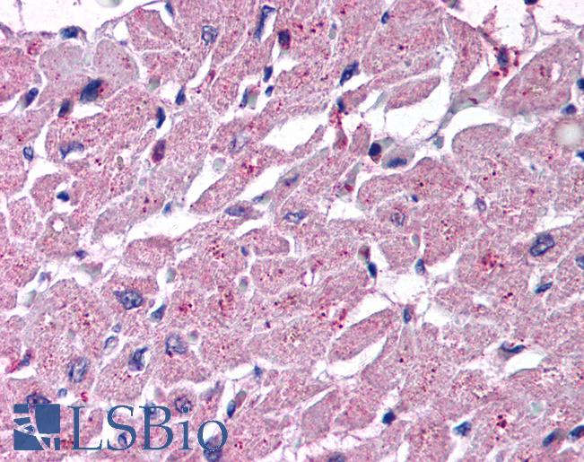 Anti-CYSLTR2 / CYSLT2 antibody LS-A2255 IHC of human heart. Immunohistochemistry of formalin-fixed, paraffin-embedded tissue after heat-induced antigen retrieval.