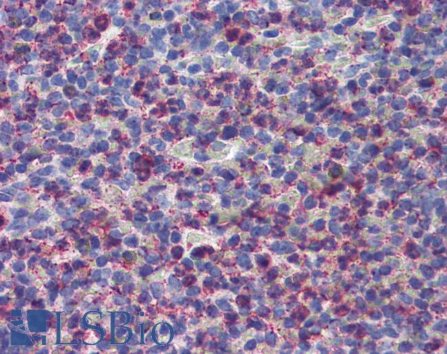 Anti-CYSLTR2 / CYSLT2 antibody LS-A3305 IHC of human spleen. Immunohistochemistry of formalin-fixed, paraffin-embedded tissue after heat-induced antigen retrieval.