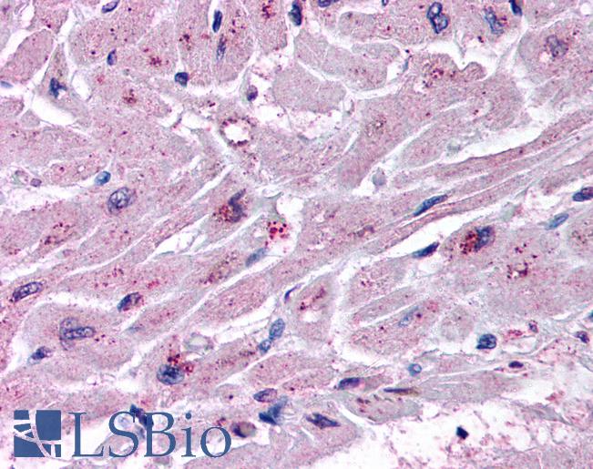 Anti-CYSLTR2 / CYSLT2 antibody LS-A3305 IHC of human heart. Immunohistochemistry of formalin-fixed, paraffin-embedded tissue after heat-induced antigen retrieval.