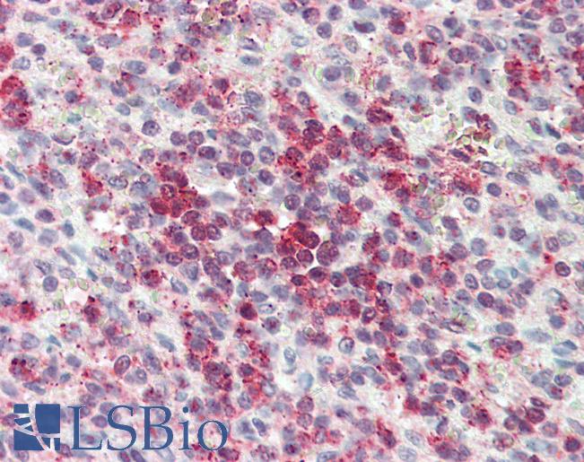 Anti-CYSLTR2 / CYSLT2 antibody LS-A473 IHC of human spleen. Immunohistochemistry of formalin-fixed, paraffin-embedded tissue after heat-induced antigen retrieval.