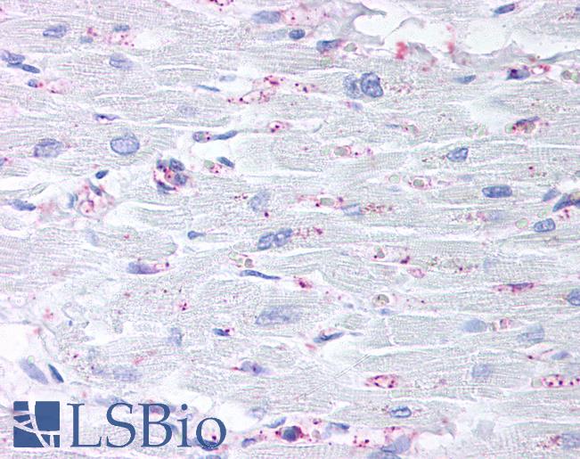 Anti-CYSLTR2 / CYSLT2 antibody LS-A473 IHC of human heart. Immunohistochemistry of formalin-fixed, paraffin-embedded tissue after heat-induced antigen retrieval.