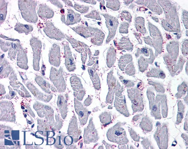 Anti-CYSLTR2 / CYSLT2 antibody LS-A512 IHC of human heart. Immunohistochemistry of formalin-fixed, paraffin-embedded tissue after heat-induced antigen retrieval.