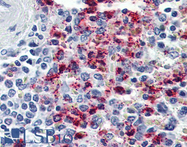 Anti-CYSLTR2 / CYSLT2 antibody LS-A512 IHC of human spleen. Immunohistochemistry of formalin-fixed, paraffin-embedded tissue after heat-induced antigen retrieval.