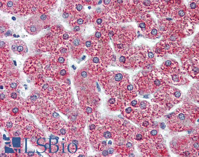 Anti-CYSLTR2 / CYSLT2 antibody LS-A512 IHC of human liver. Immunohistochemistry of formalin-fixed, paraffin-embedded tissue after heat-induced antigen retrieval.