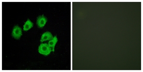 Immunofluorescence of HUVEC cells, using CLTR1 Antibody. The picture on the right is treated with the synthesized peptide.