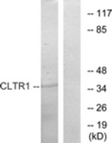Western blot of extracts from COS7 cells, using CLTR1 Antibody. The lane on the right is treated with the synthesized peptide.