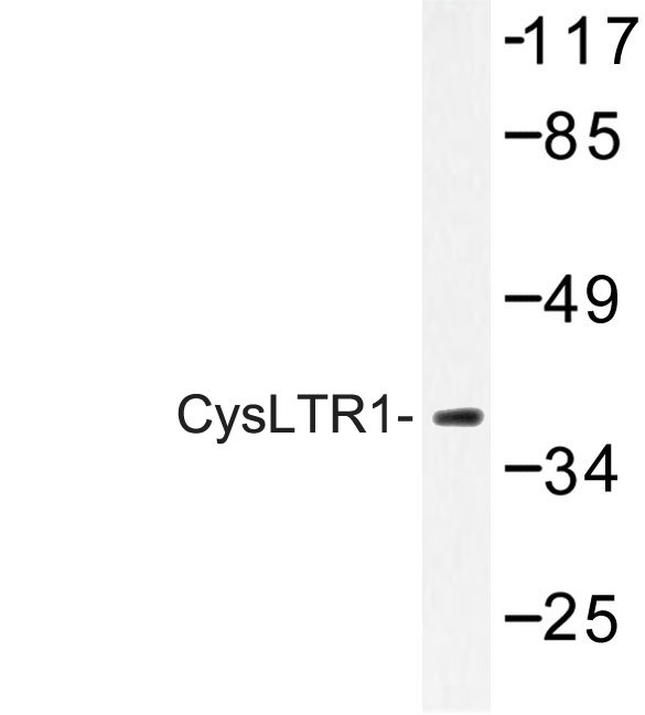 Western blot of CysLTR1 (C173) pAb in extracts from COLO205 cells.