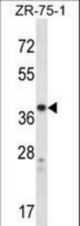 CYSLTR1 Antibody western blot of ZR-75-1 cell line lysates (35 ug/lane). The CYSLTR1 antibody detected the CYSLTR1 protein (arrow).