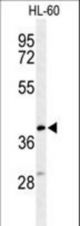 Western blot of CYTB Antibody in HL-60 cell line lysates (35 ug/lane). CYTB (arrow) was detected using the purified antibody.