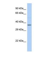 Western blot of Human Fetal Liver. cytb antibody dilution 1.0 ug/ml.