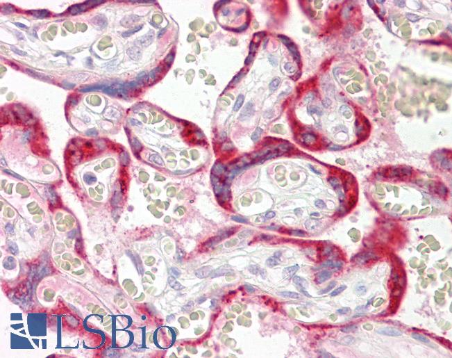 Anti-CYTB / MT-CYB antibody IHC of human placenta. Immunohistochemistry of formalin-fixed, paraffin-embedded tissue after heat-induced antigen retrieval. Antibody LS-B8199 dilution 2.5-5 ug/ml.