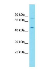 Western blot of Human MDA-MB-435S. CYTH2 antibody dilution 1.0 ug/ml.
