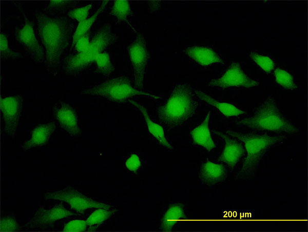 Immunofluorescence of monoclonal antibody to PSCD2 on HeLa cell (antibody concentration 10 ug/ml).