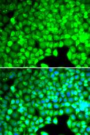 Immunofluorescence blot of U20S cell using CYTH2 antibody. Blue: DAPI for nuclear staining.