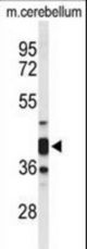 Western blot of CYTH3 Antibody in mouse cerebellum tissue lysates (35 ug/lane). CYTH3 (arrow) was detected using the purified antibody.