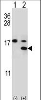 Western blot of S100A11 (arrow) using rabbit polyclonal S100A11 Antibody (S6). 293 cell lysates (2 ug/lane) either nontransfected (Lane 1) or transiently transfected (Lane 2) with the S100A11 gene.