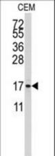 Western blot of anti-S100A11 Antibody (S6) in CEM cell line lysates (35 ug/lane). S100A11 (arrow) was detected using the purified antibody.