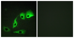 Immunofluorescence of HepG2 cells, using Calmodulin (Ab-79/81) Antibody. The picture on the right is treated with the synthesized peptide.